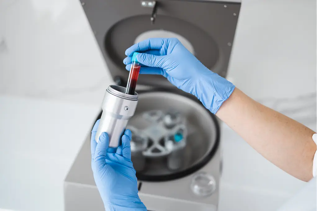 ccc what is haematology